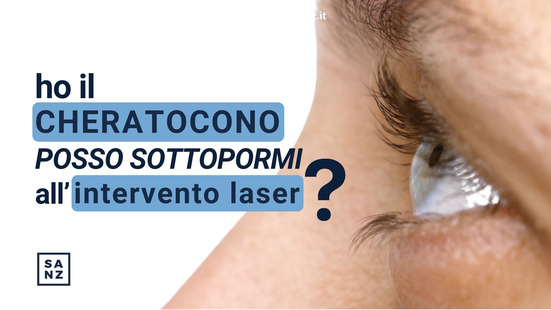 Ho il cheratocono, posso sottopormi all’Intervento Laser?